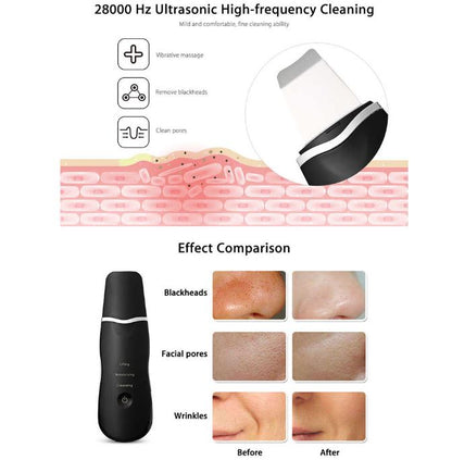 Rechargeable Ultrasonic Facial Cleanser