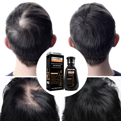 Anti Hair Loss Hair Growth Shampoo 250ml